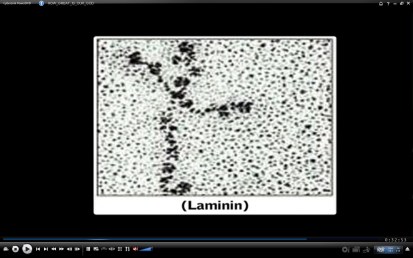 laminin2